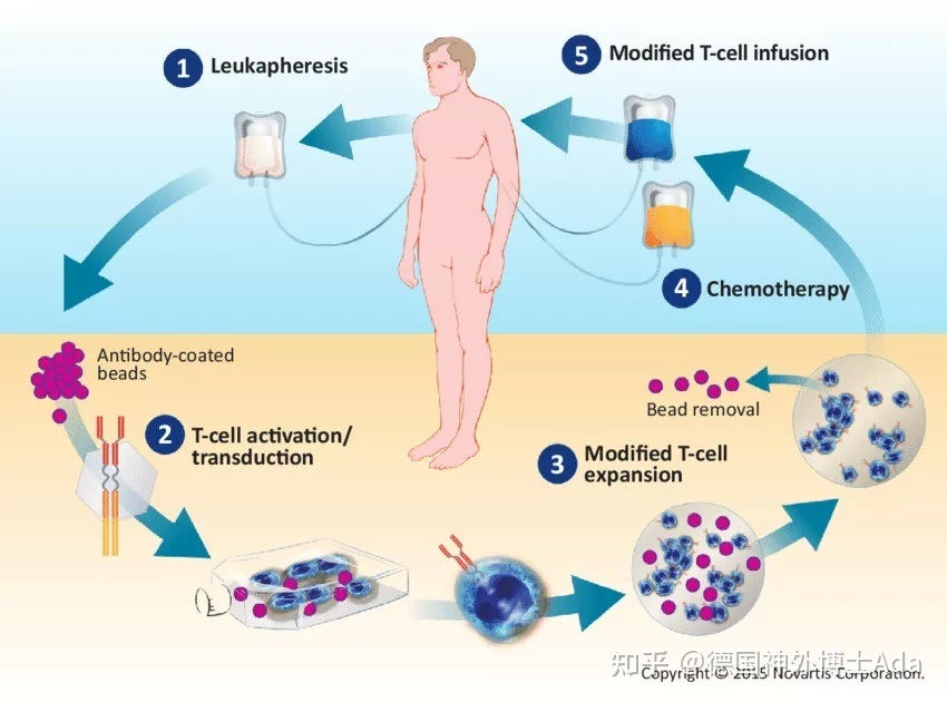 实体瘤新进展：NK细胞用了21天消灭它！
