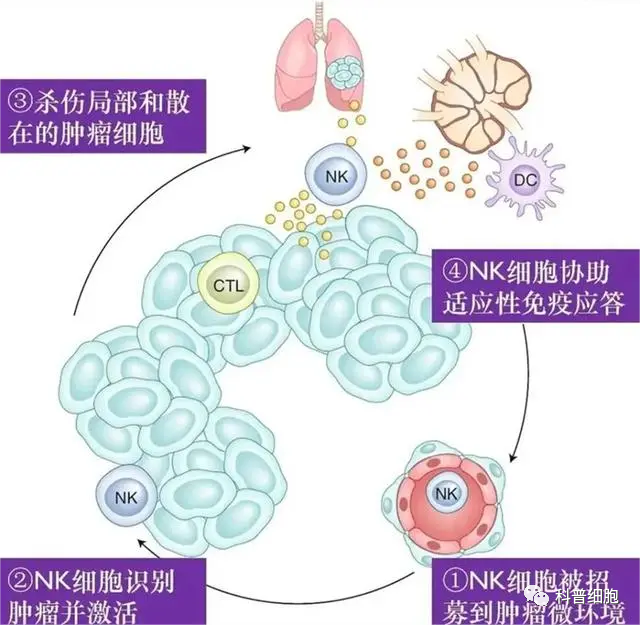 真实案例：胰腺癌多次治疗无果，细胞疗法显著延长生存期！