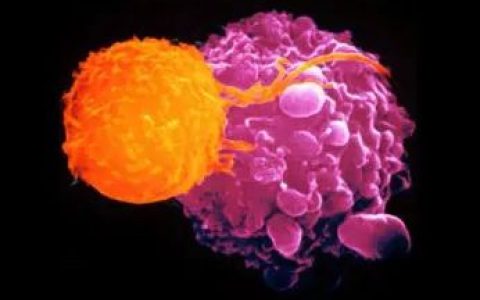 NK细胞，控制肿瘤转移的辅助之道