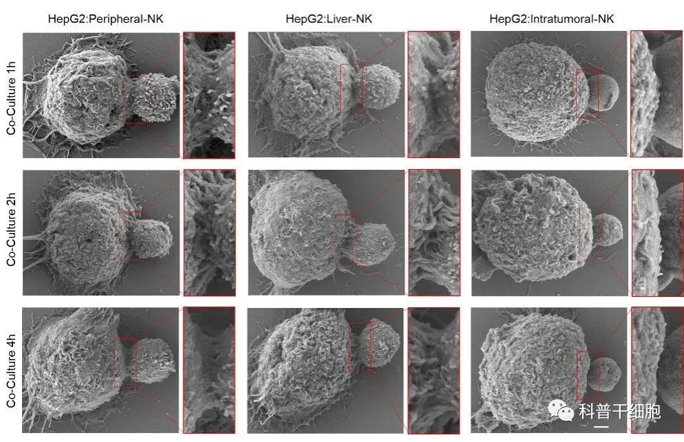 Nature子刊：中国科学技术大学发现NK细胞失去抗癌功能新机制