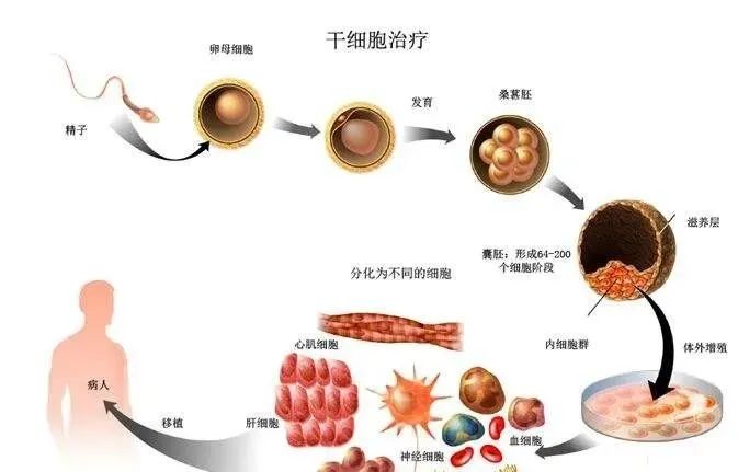 关于干细胞治疗糖尿病的十问十答