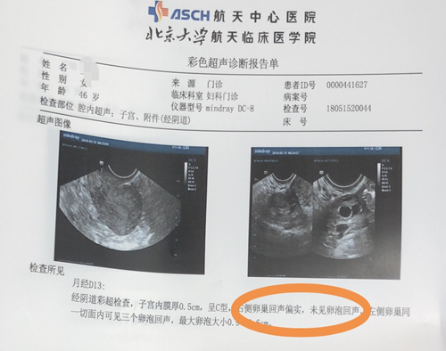 案例 | 干细胞治疗卵巢早衰，有效改善卵巢功能