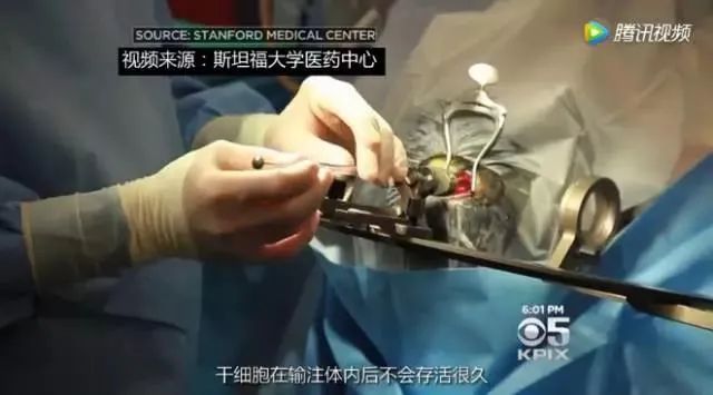 30岁后，每十年一道坎儿，干细胞技术帮你征服人生每一道病坎！