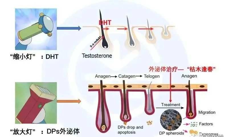 外泌体 | 解决“阳康”后脱发问题