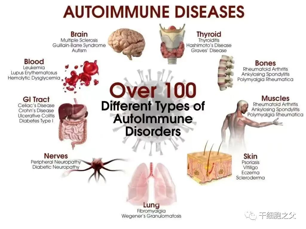 间充质干细胞：80多种自身免疫性疾病治疗的新选择