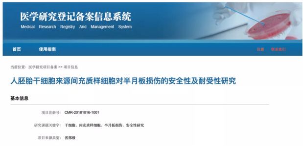 4个临床案例佐证：干细胞治愈半月板损伤更具有优势