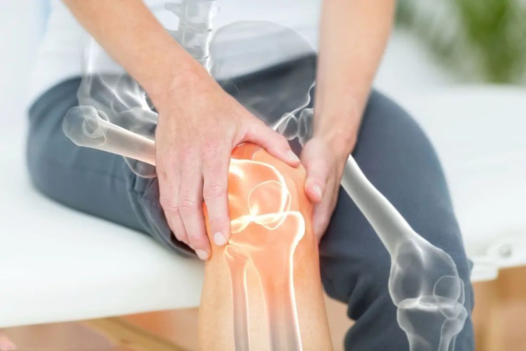 干细胞让骨关节炎患者软骨持续再生