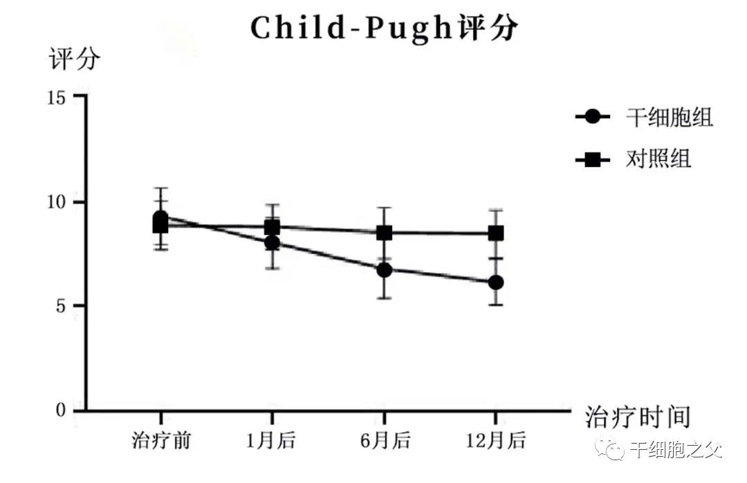 干细胞治疗肝硬化的3项临床研究