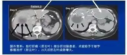 国内70%的人处在“亚健康”状态，细胞故障为亚健康祸源