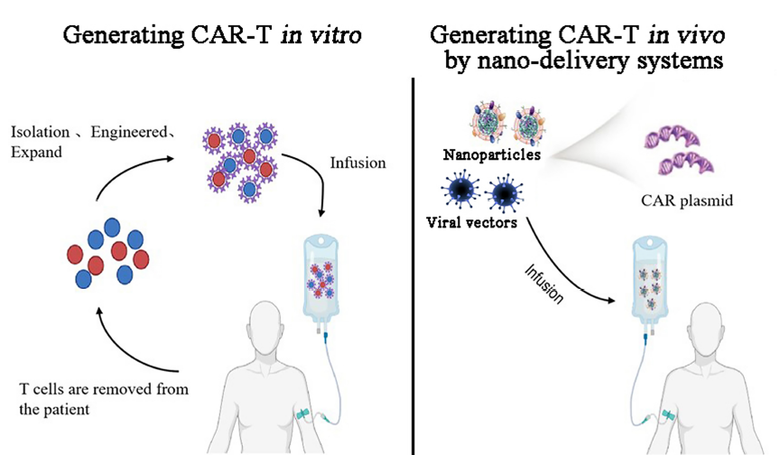 体内诱导CAR-T细胞：有望突破当前CAR-T细胞治疗的障碍