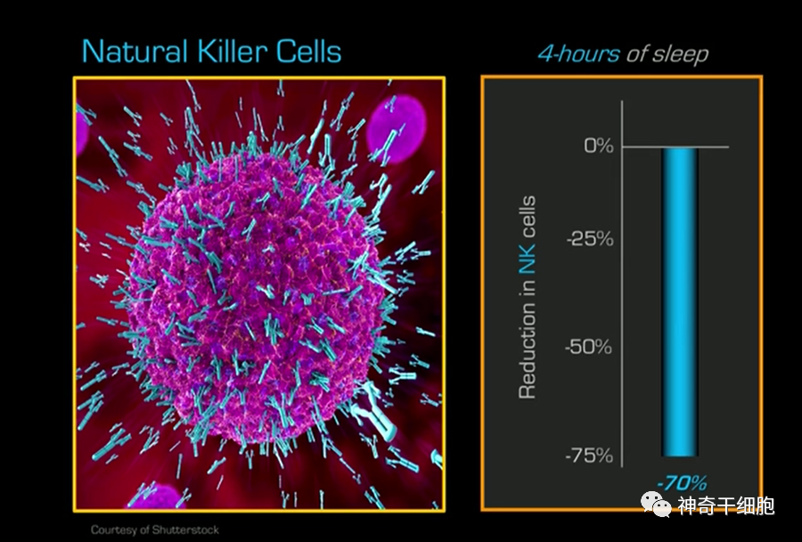 少睡短命！低质量睡眠影响免疫，NK细胞活性下降70%！