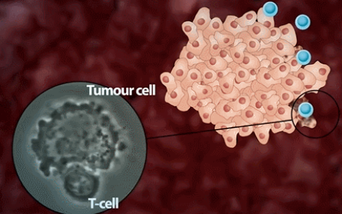 自体免疫CIK细胞治疗：显著降低血液中肿瘤标志物癌胚抗原（CEA）