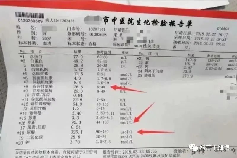 治疗痛风不止有药物，还有神奇的干细胞，止痛更“治痛”！