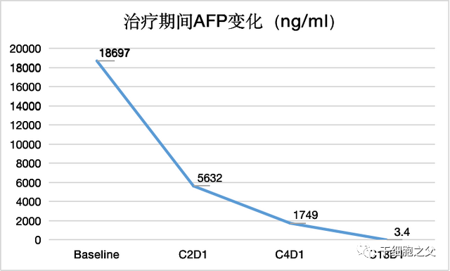 肝癌术后复发伴肺部转移，细胞免疫疗法成功消除肿瘤