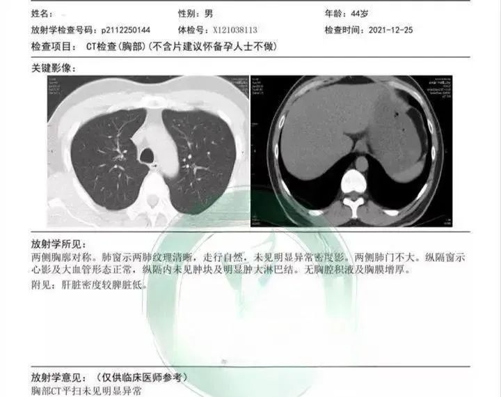 细胞疗法丨肺部结节癌变之前，免疫细胞疗法可使其缩小甚至消失！