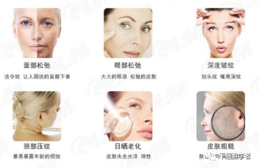 都2023了还在做传统美容？细胞抗衰才是富人们的香饽饽！
