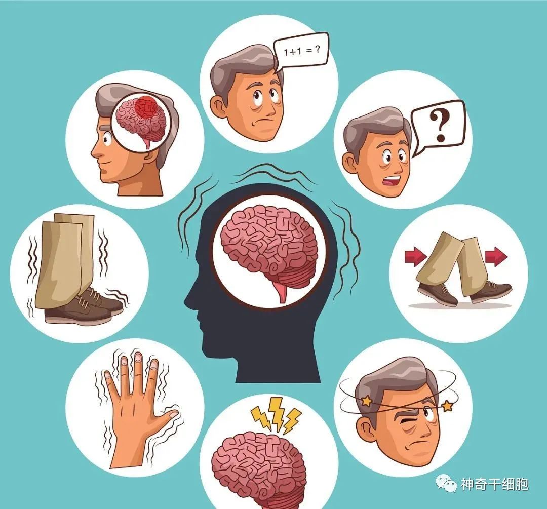 造福神经系统疾病患者！新政策重点推动细胞治疗