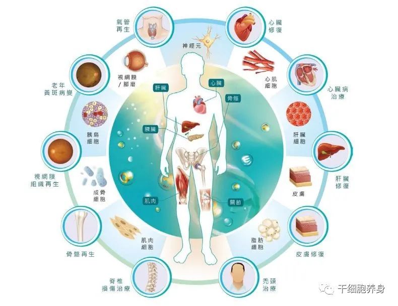 关于干细胞治疗的八大误区