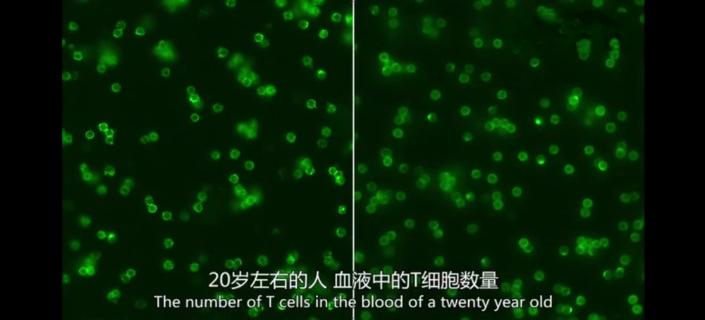 20岁和60岁时你的免疫细胞有什么不同