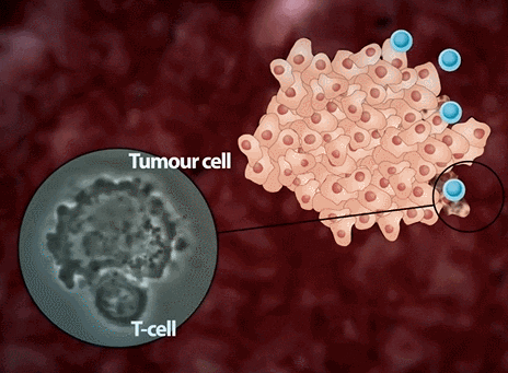 CIK细胞72小时到达肿瘤部位，多项临床研究表明显著提升5年生存率