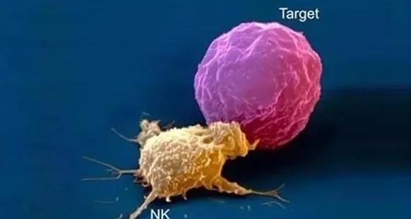 细谈NK细胞免疫疗法及其应用