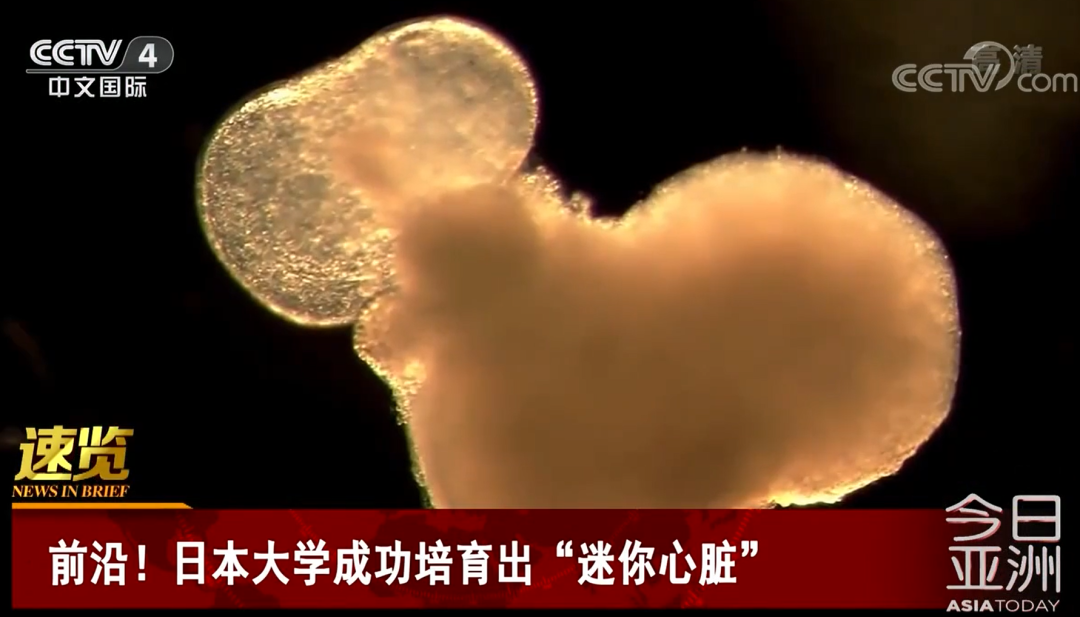 改写现状！全球最大规模心衰试验：干细胞让心衰患者心梗、中风发生率降低58%，可长期改善预后