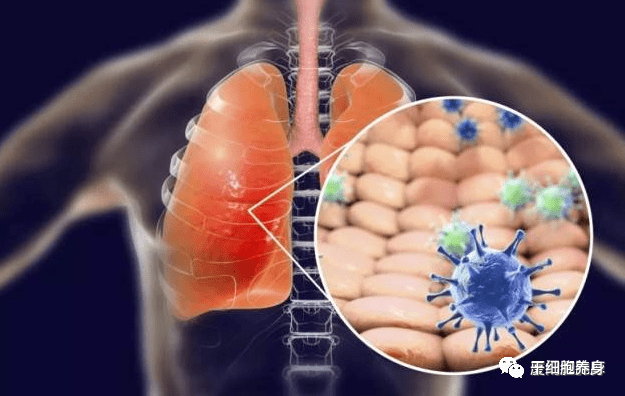 干细胞治疗肺纤维化的临床案例