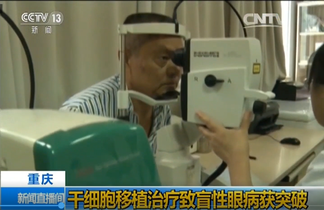 央视新闻：干细胞移植治疗致盲性眼病获重大突破（第三军医大）