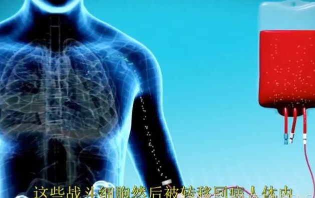 【收藏】免疫细胞疗法的详细解说~
