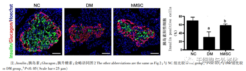 解放军总医院 | 间充质干细胞移值有效降低血糖、改善胰岛素敏感性,并增加胰岛内 β 细胞数量