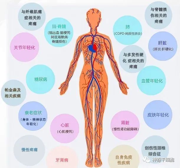 细胞科普丨干细胞迎战200种适应症和8大系统疾病