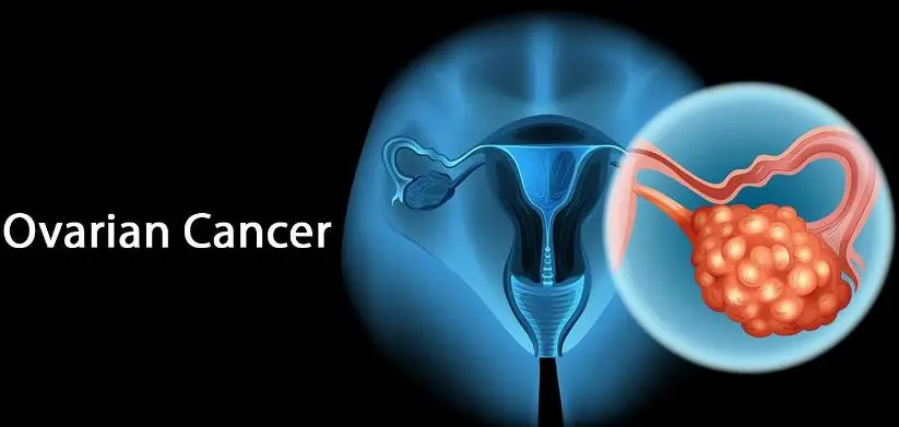 卵巢癌晚期多发转移，NK细胞调理帮她实现长期生存