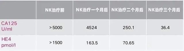 卵巢癌晚期多发转移，NK细胞调理帮她实现长期生存