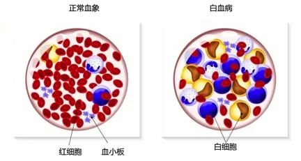 干细胞疗法的十大适应症