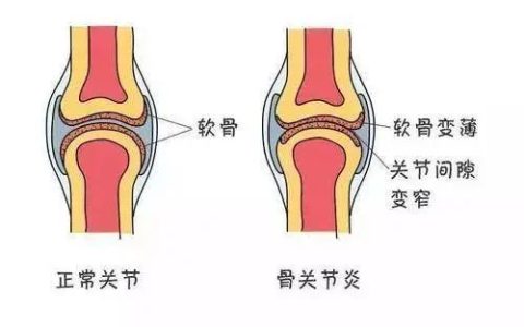 干细胞疗法的十大适应症