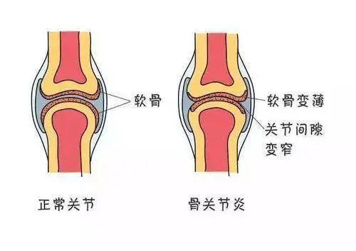 干细胞疗法的十大适应症