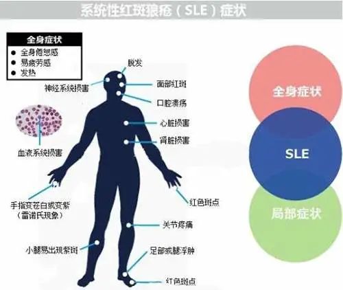 干细胞疗法的十大适应症