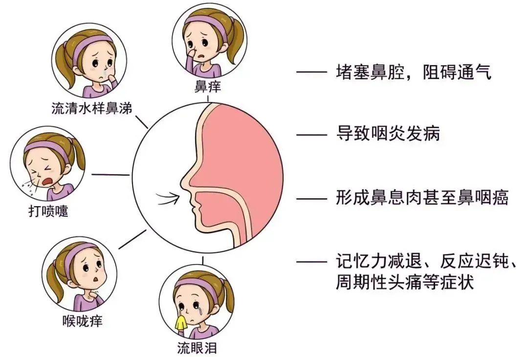 干细胞疗法：下一个过敏疾病的曙光，为过敏患者带来新机遇