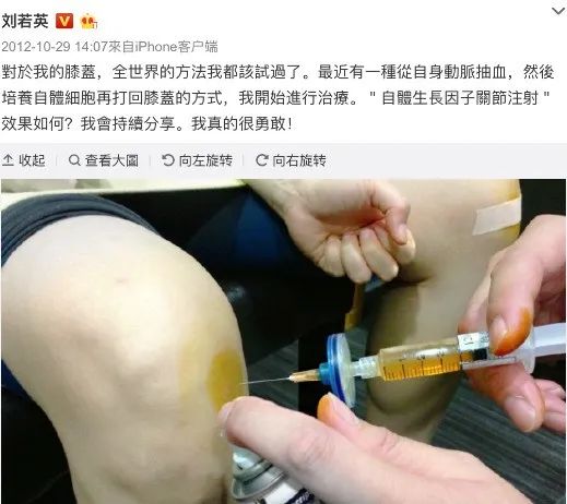 神奇的细胞疗法：揭秘90%的明星们重返健康活力的神秘力量！