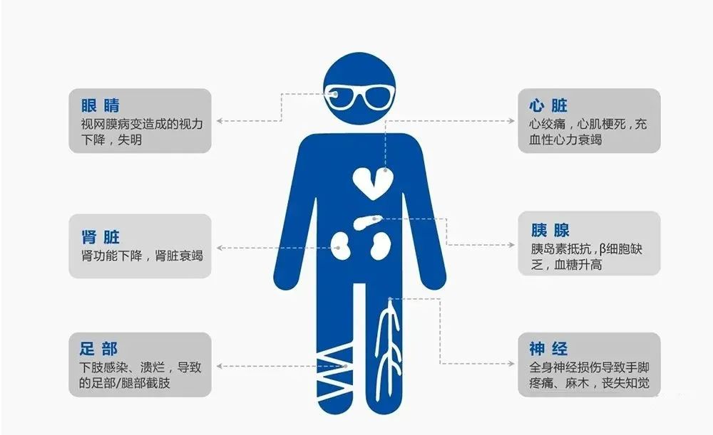 干细胞真能治疗糖尿病吗？关于干细胞修复糖尿病的10问10答