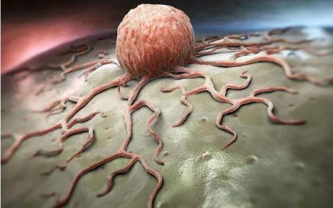 癌症化疗效果不明显？细胞免疫疗法联合化疗，更好的抗肿瘤疗效