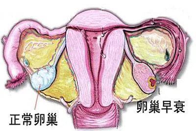 逆转更年期！干细胞解决卵巢早衰和提前闭经问题