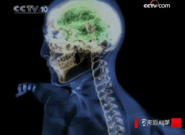 临床案例丨CCTV：健硕青年成为植物人，干细胞治疗让他重获新生