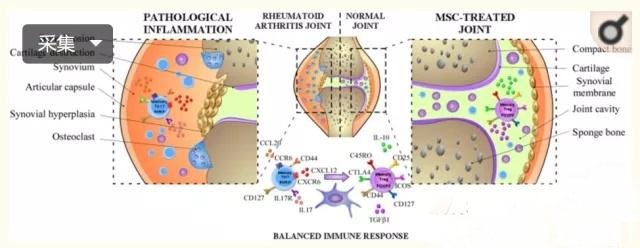 如何拯救类风湿性关节炎？干细胞疗法给出显著答案！治疗效果杠杠的！