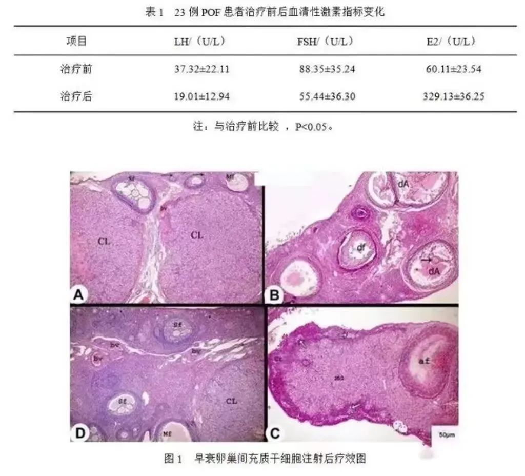 临床证实｜干细胞治愈卵巢早衰！痊愈10例，有效治疗13例，成功率高达92％