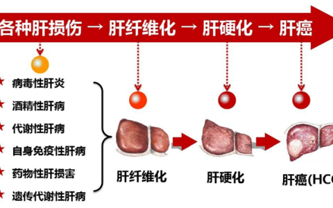 干细胞治疗肝硬化的作用与机制