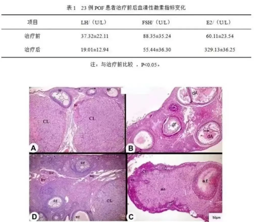 25名卵巢早衰患者接受干细胞治疗，实现92%的显著疗效!