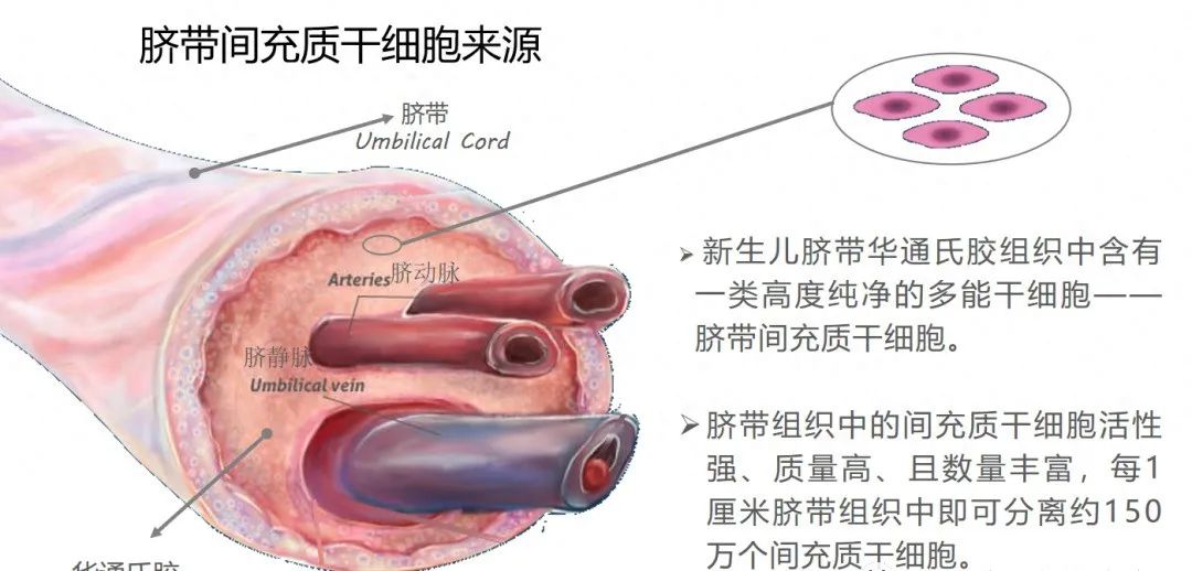 临床研究 | 秋季痛风高发期来临，浅谈干细胞干预痛风的作用机制