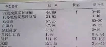 案例｜干细胞治疗痛风 ， 一次也没发作，尿酸指标恢复正常