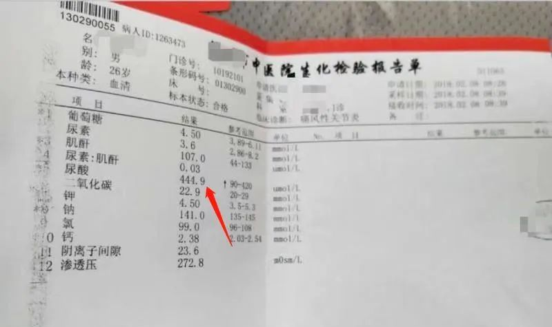 案例｜干细胞治疗痛风 ， 一次也没发作，尿酸指标恢复正常
